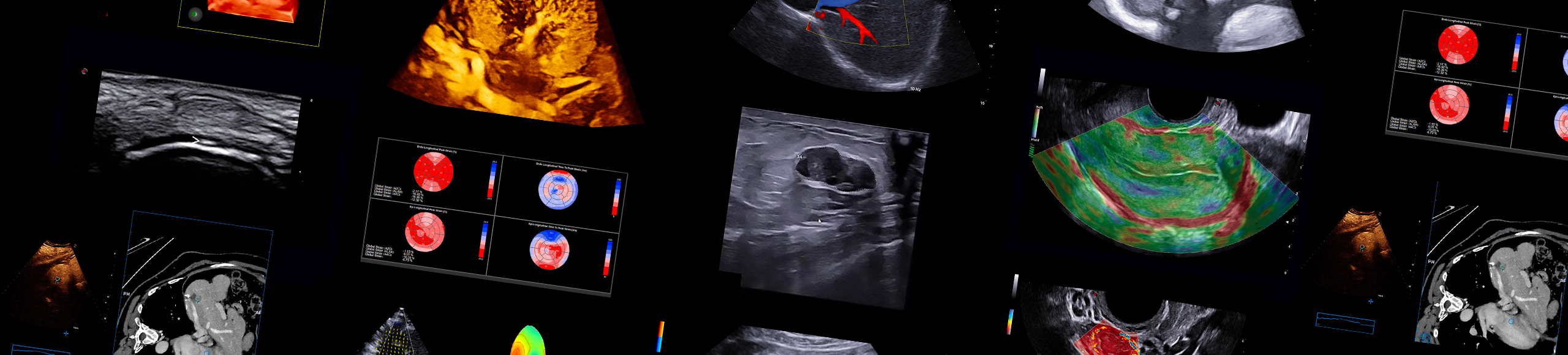 Ultrasound Clinical Images
