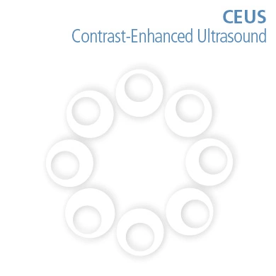 CEUS Contrast-Enhanced Ultrasound