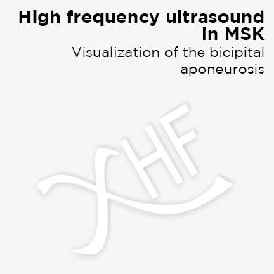 High Frequency Ultrasound in MSK