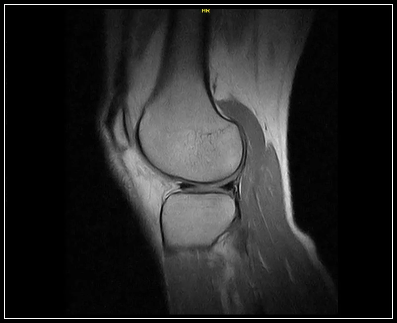 G-scan Brio - Knee - FSE PD Sagittal