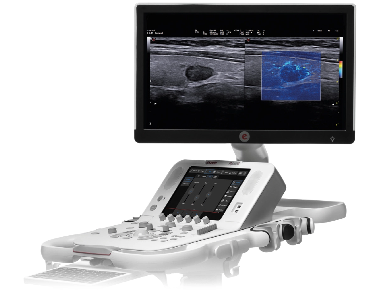 MyLab™X8 Platform ultrasound system offering a brand new ultrasound experience.