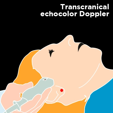 Transcranical echocolor Doppler