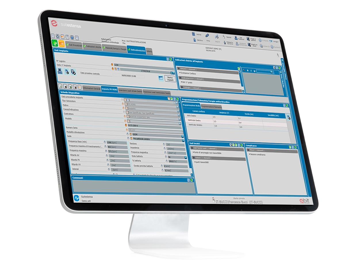 SUITESTENSA EP-Lab Data management, dedicated to electrophysiology laboratories