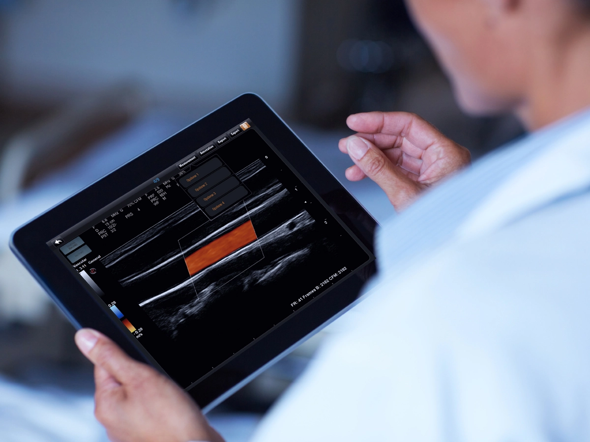 MyLab™Omega eXP ultrasound system provides Esaote Augmented Insight™ technology