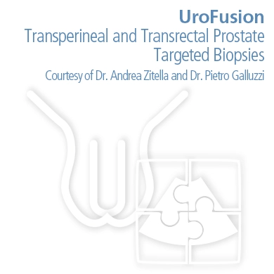 UroFusion Transperineal and Transrectal Prostate Targeted Biopsies