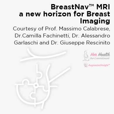 BreastNav™ MRI, a new horizon for Breast Imaging