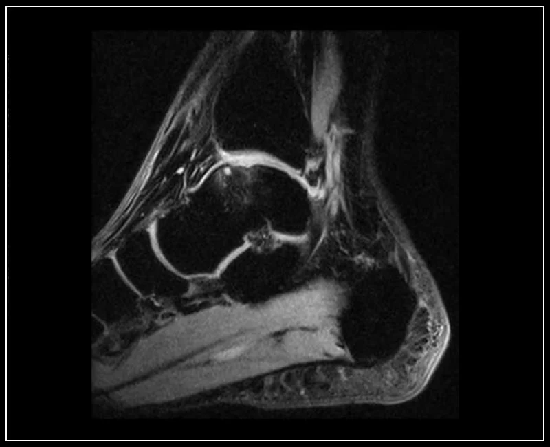 O-scan - Ankle - XBone Sagittal