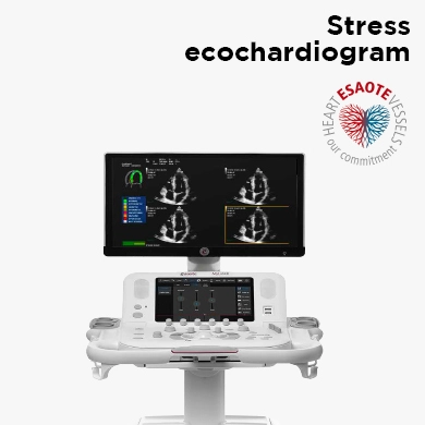 Stress echocardiogram