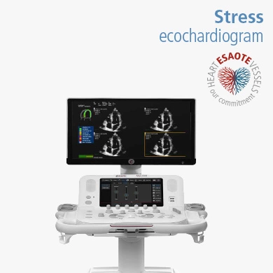 Stress echocardiogram