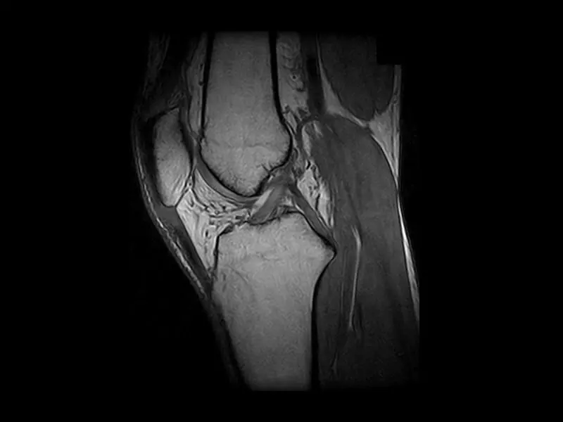 S-scan Open - 3D Sharc Sagittal Knee