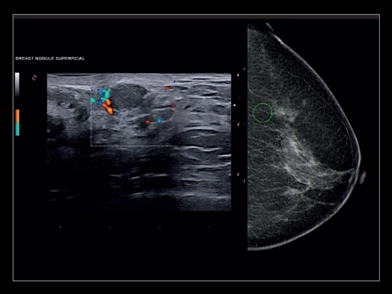 MyLab™X8 Platform - Accurate multimodality diagnosis with Follow Up and BodyMap