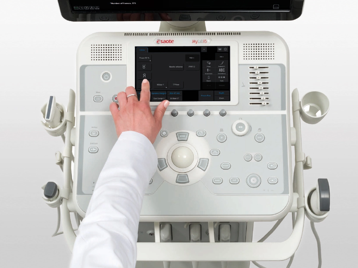 MyLab™X5 ultrasound system console