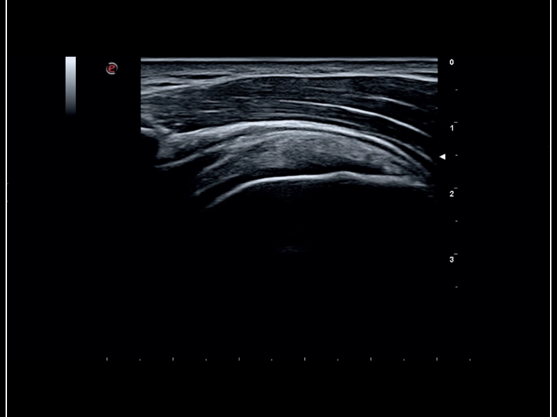 MyLab™Sigma - MSK imaging of the shoulder