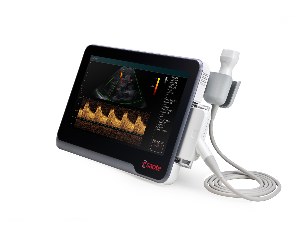 MyLab™X1 full touchscreen ultrasound device