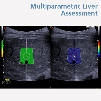 Multiparametric Liver Assessment