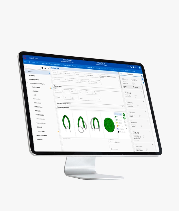 SUITESTENSA US, cardiovascular information system