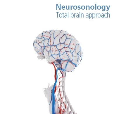Brochure Neurosonolgy, total brain approach