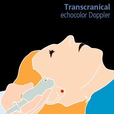 Transcranical echocolor Doppler