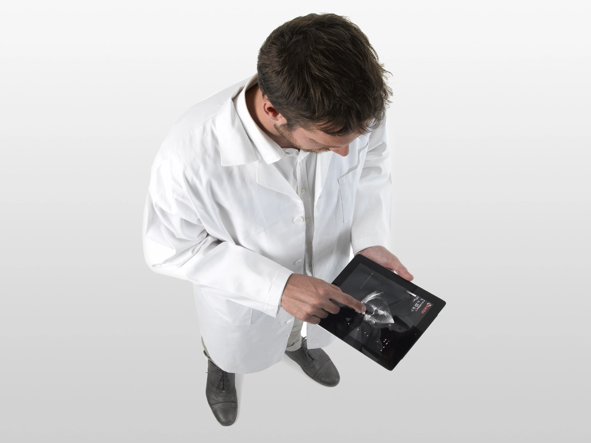 MyLab™Omega ultrasound system can offer a large variety of mobile solutions