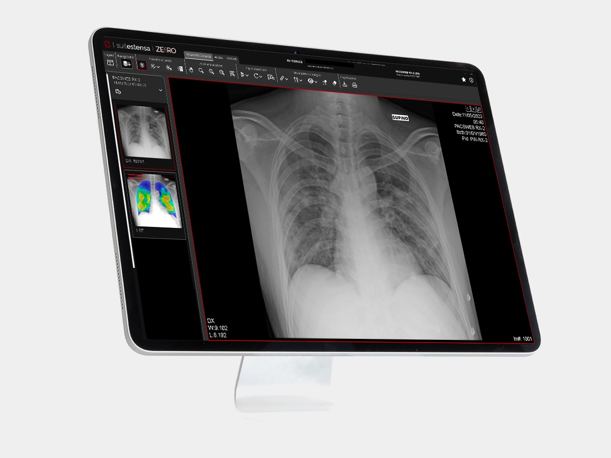 Suitestensa Zefiro- Next generation of diagnostic solutions