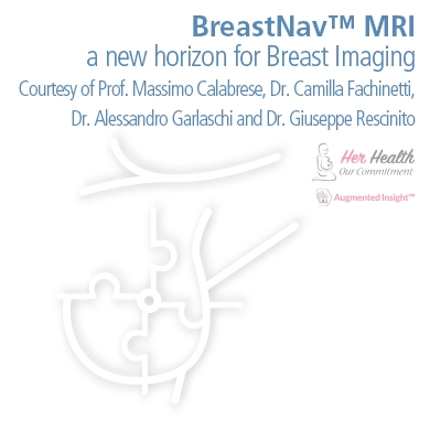 BreastNav™ MRI, a new horizon for Breast Imaging