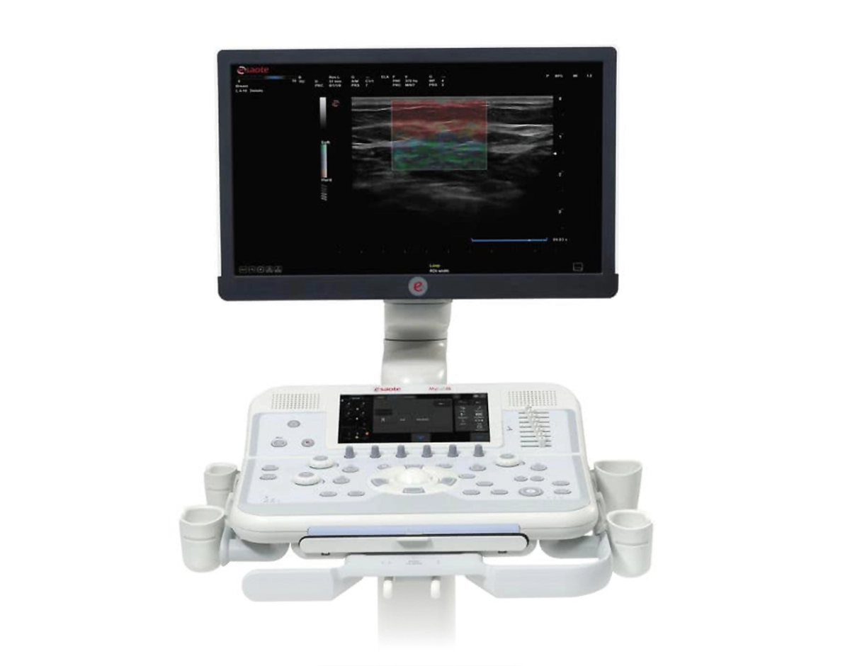 MyLab™X6 cart based ultrasound system with 21.5” HD IPS technology LED monitor