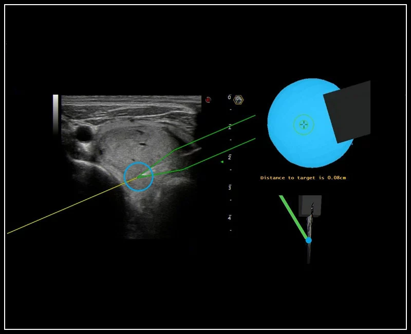 MyLab™9 Platform - Precise lesion detection and guidance with Virtual Biopsy