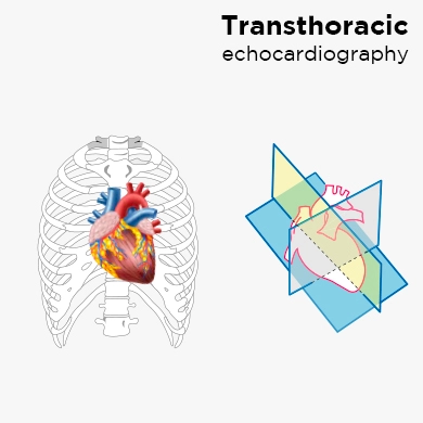 Transthoracic echocardiography