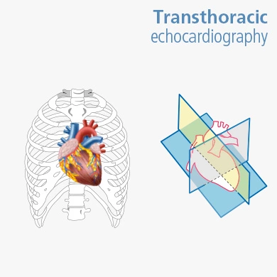 Transthoracic echocardiography