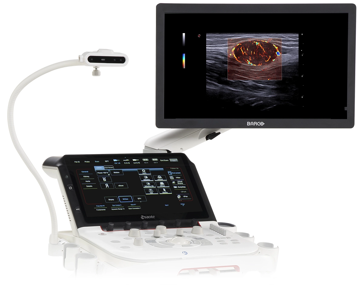 MyLab™X90, Premium Ultrasound system with Augmented Insight™