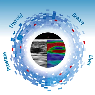 Real-Time Elastosonography