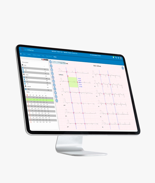 SUITESTENSA ECG Data Management