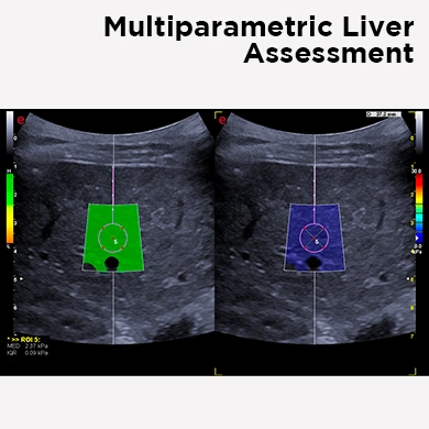 Multiparametric Liver Assessment