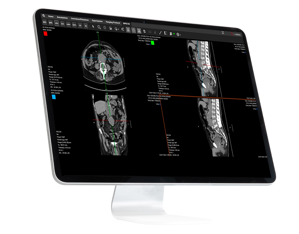 Suitestensa UniViewer enterprise imaging software