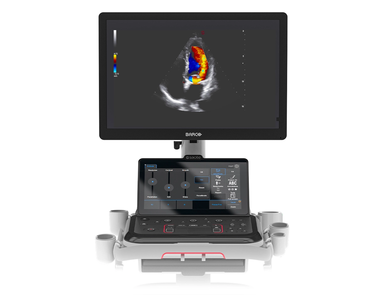 MyLab™A70 ultrasound system with 24’’ OPTILIGHT BARCO MONITOR and multi-function tablet-like touchscreen
