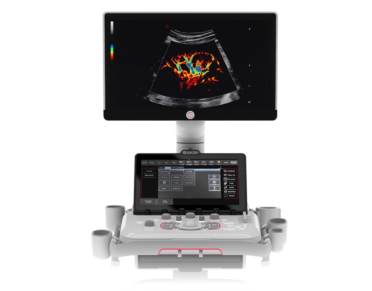 MyLab™A50 versatile ultrasound system