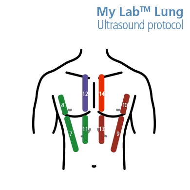 MyLab Lung Ultrasound Protocol