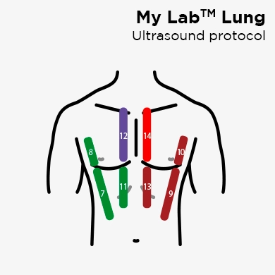 MyLab Lung Ultrasound Protocol