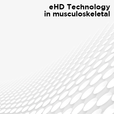 EHD Technology in Musculoskeletal The New Era in Ultrasound