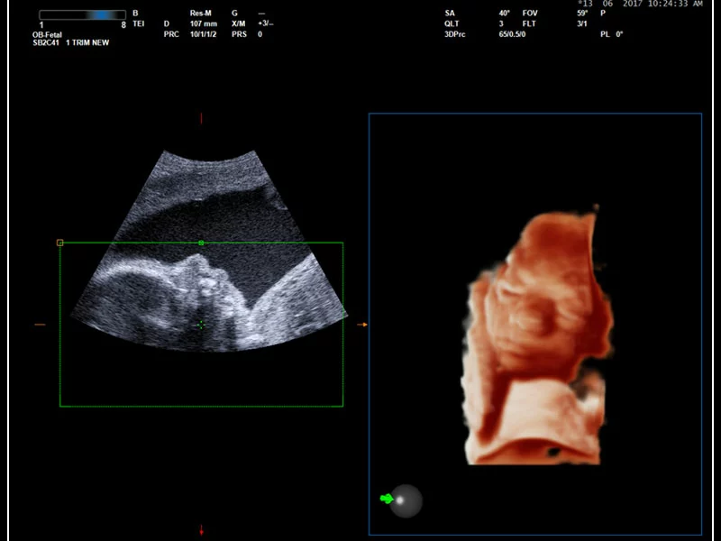 MyLab™9 Platform - Real-time baby face with 4D imaging