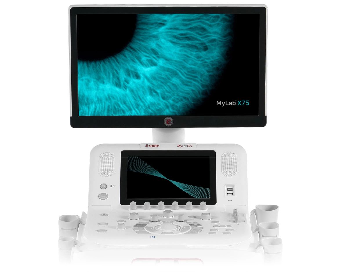 MyLab™X75 ultrasound system