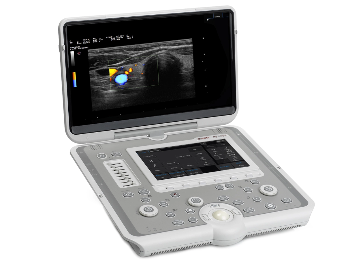 MyLab™Sigma smart, portable, multidisciplinary ultrasound system