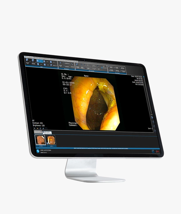 SUITESTENSA Endo enterprise imaging software