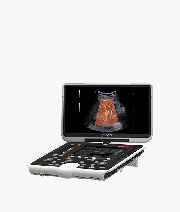 MyLab™Omega eXP ultrasound system